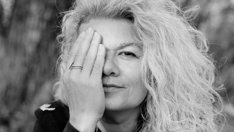 Monica Freire, in black and white, one hand covering her right eye 